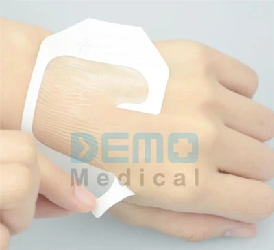 6 cm*7 cm μίας χρήσης eosterile διαφανές ντύσιμο πληγών με απορροφητικό μαξιλάρι